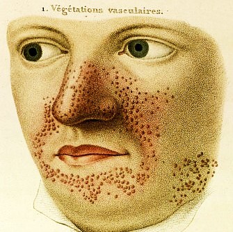 Medical Anthropology for the Skin